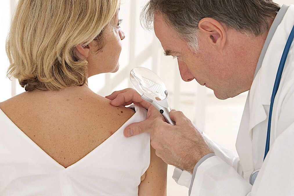 diagnosis of human papillomavirus